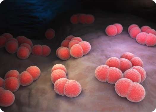 Ilustración de los síntomas de la meningitis