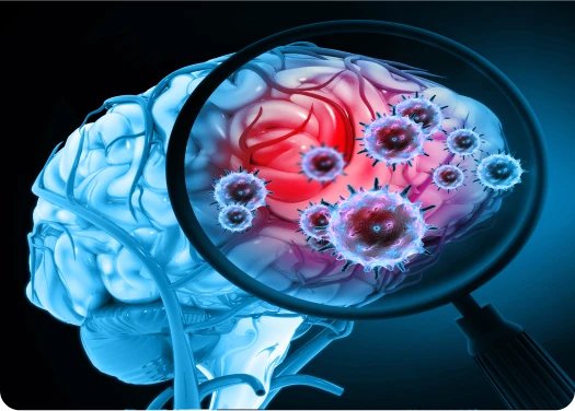 ¿Qué es la meningitis meningocócica?
